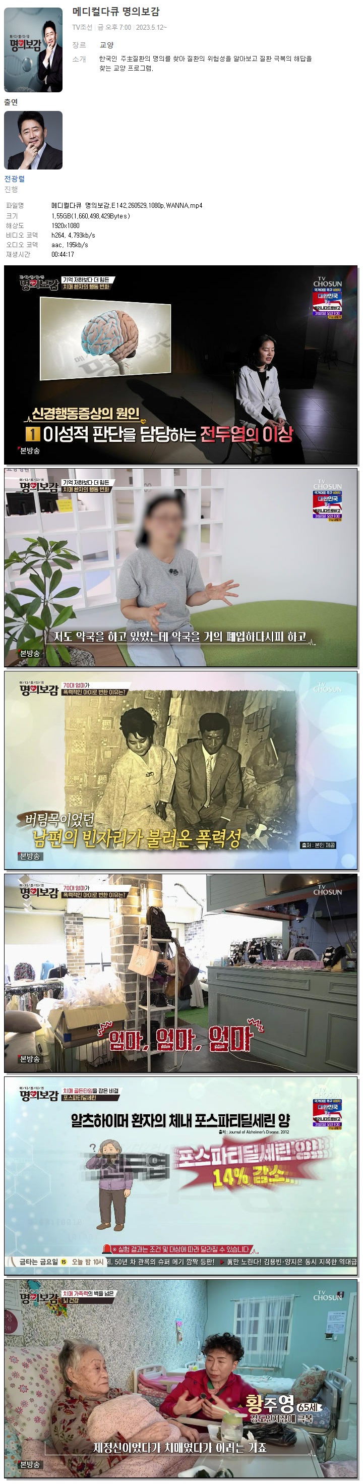 메디컬다큐 명의보감.E142.260529.1080p.WANNA